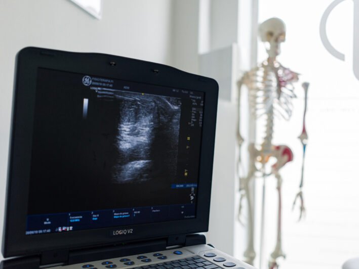 news-ecografia